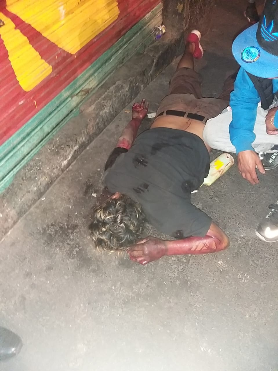 Inexplicablemente le disparan por la espalda cuando caminaba por Ermita