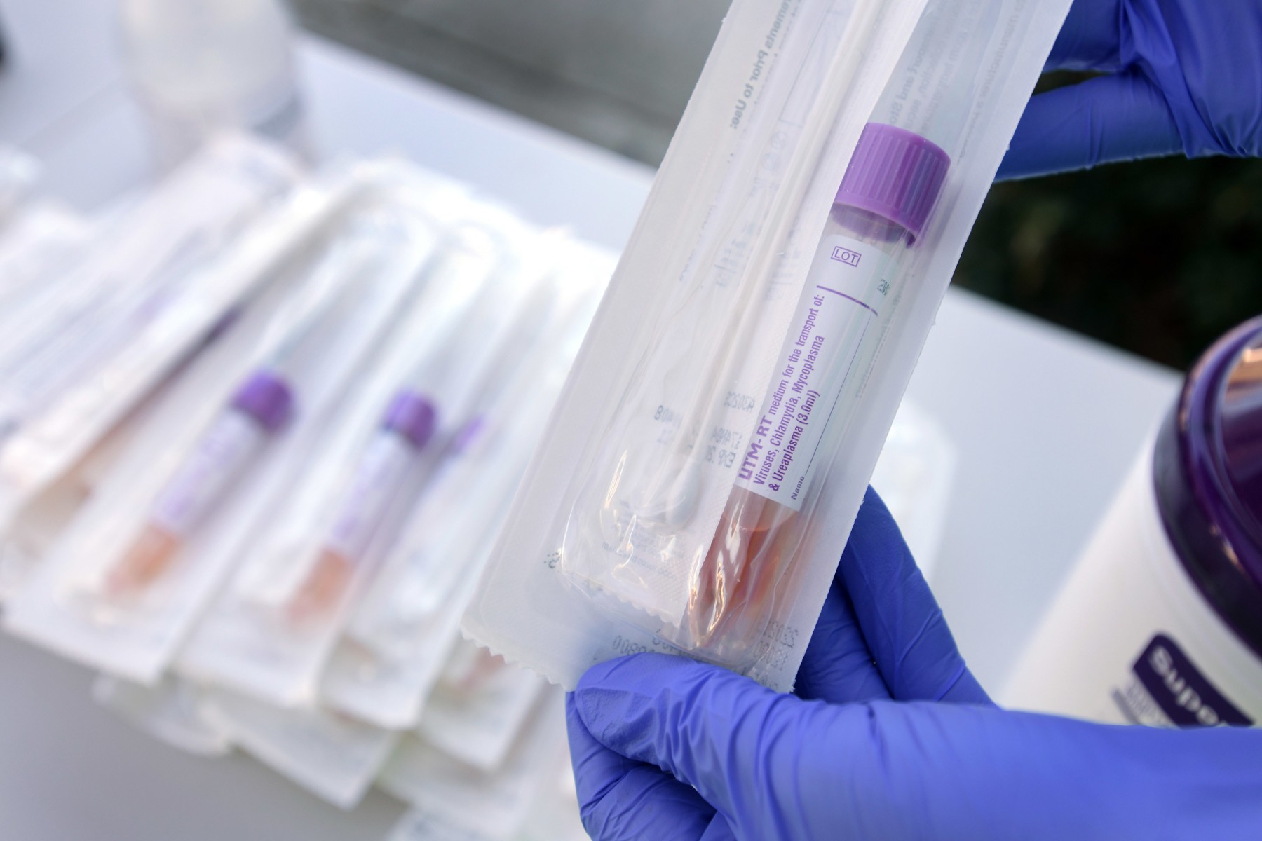 El Gobierno de la CDMX aplicará 100 mil pruebas más para detectar al Covid-19