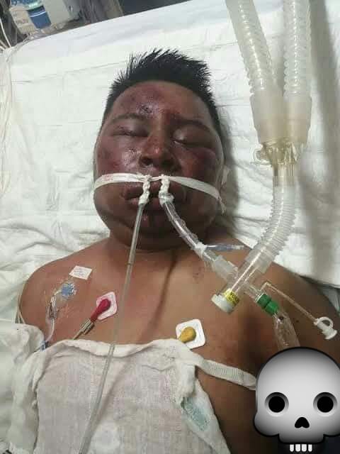 Sigue en recuperación el famoso bandido de la combi de La Muerte