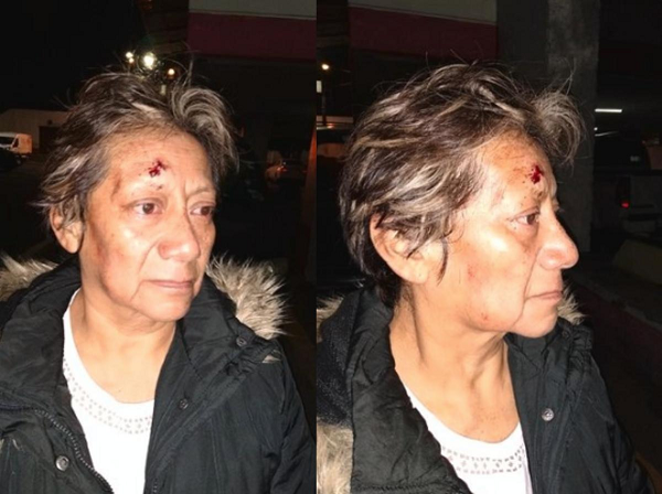 Mujer que pidió apoyo para sus hijas heridas en moto, fue agredida por policías