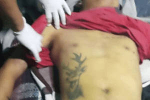 Fallece interno en un anexo de Valle de Chalco