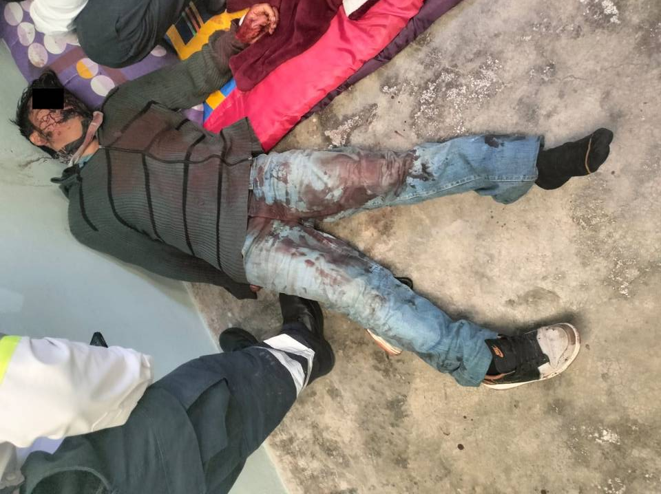 Localizan cadáver de un sujeto con varios golpes en un cuarto de Huixquilucan