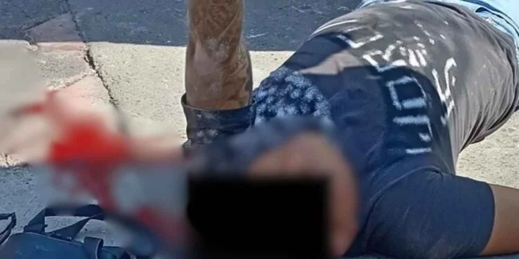 Atacan a balazos a policía en Iztapalapa; es herido en la cabeza