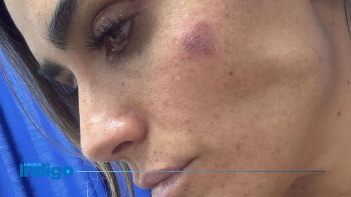 PAN CDMX exige investigación por agresión contra Alessandra Rojo de la Vega en San Cosme