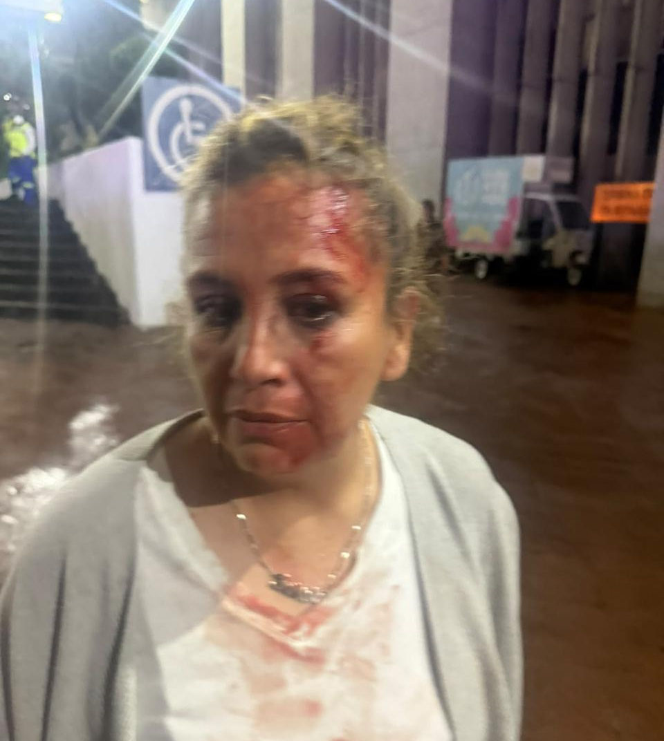 Sexoservidoras agredidas en la Cuauhtémoc por demandar vivienda